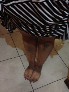 As it's been firmly established this week, I'm whiter than rice. This is what my legs and feet look like (complete with shoe lines) after a few hours outside. The black sand is real, y'all.